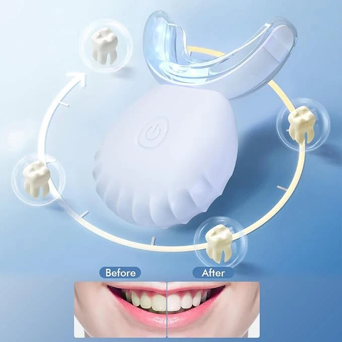 Rechargeable Teeth Whitening Light Kit - Image 2